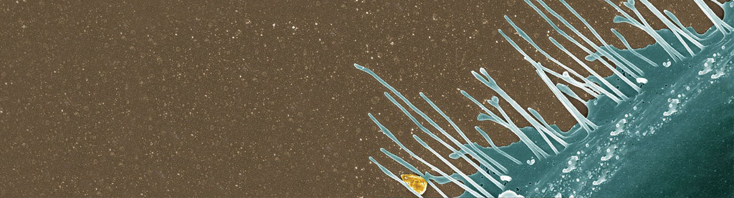 Filopódios de células da glia em cultura. Microscopia eletrônica de varredura. Autora: Marcia Áttias